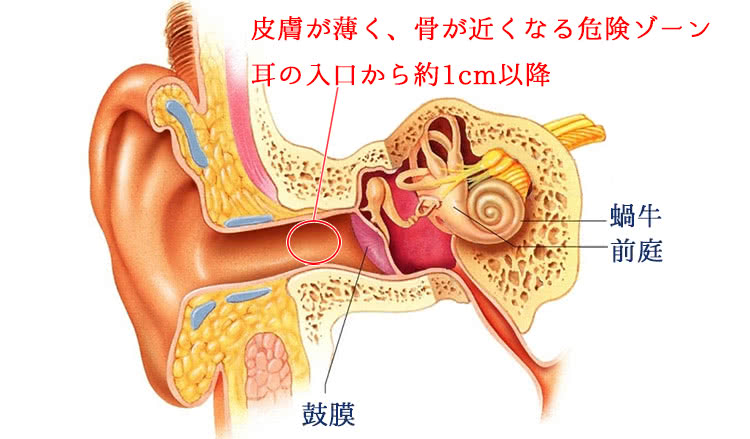 耳入り口1cm